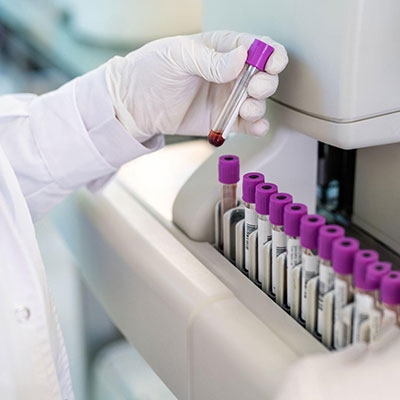 Medical oxygen sensor of blood and gas analyzer